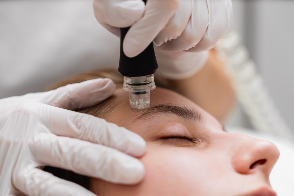 Microdermabrasion San Diego Facial Treatment